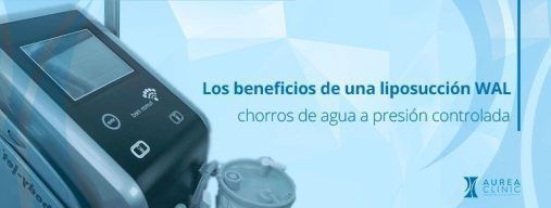 beneficios de una liposucción Sevilla