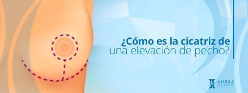 elevación mamaria cicatriz