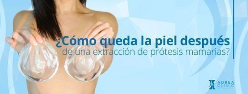 cómo queda la piel después de una extracción de prótesis Sevilla