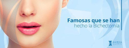 famosas que se han hecho la bichectomía Sevilla