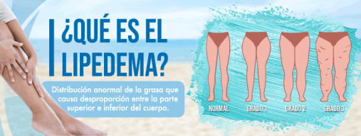 infografia lipedema causas tratamientos solucion