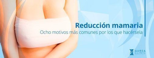 motivos reduccion mamaria sevilla