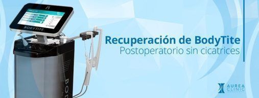 Recuperación bodytite en Sevilla