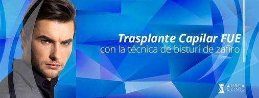 trasplante capilar fue zafiro Sevilla
